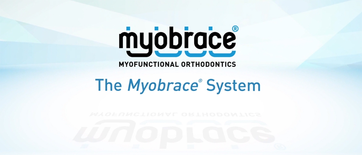 Il sistema Myobrace